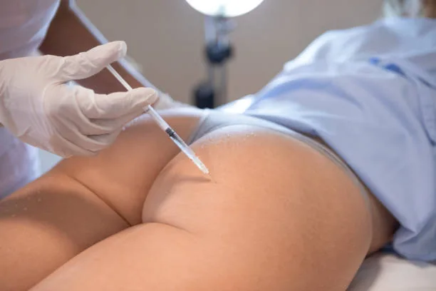 gluteofiller
