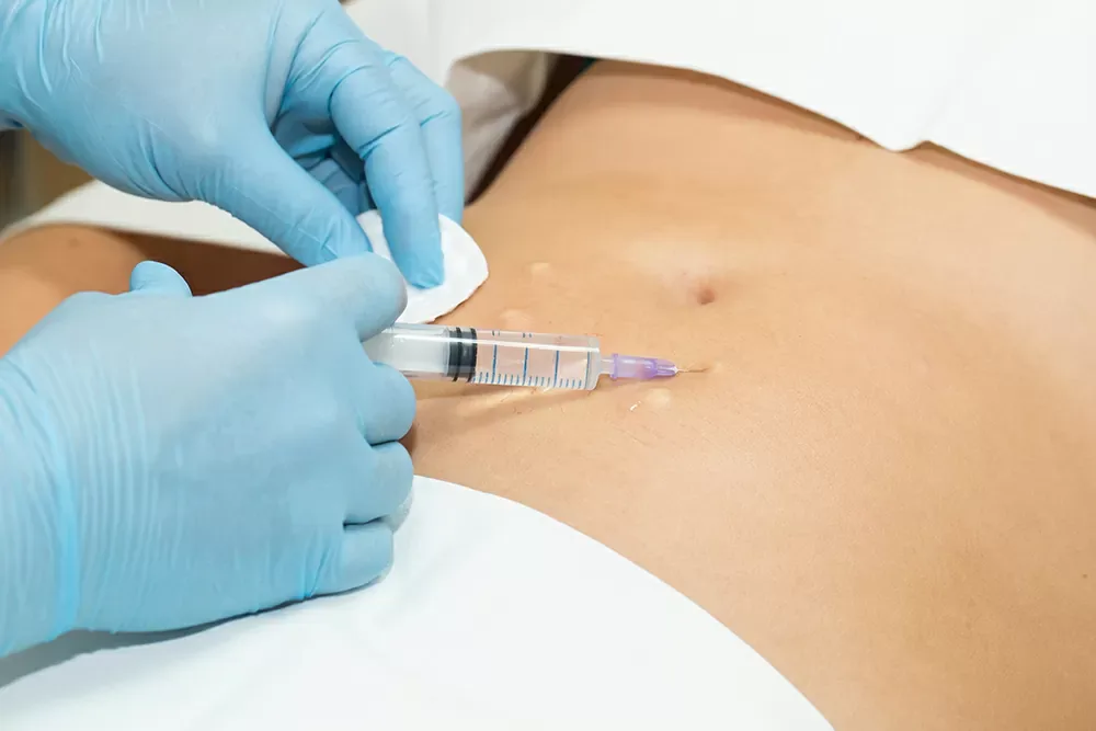 mesoterapia