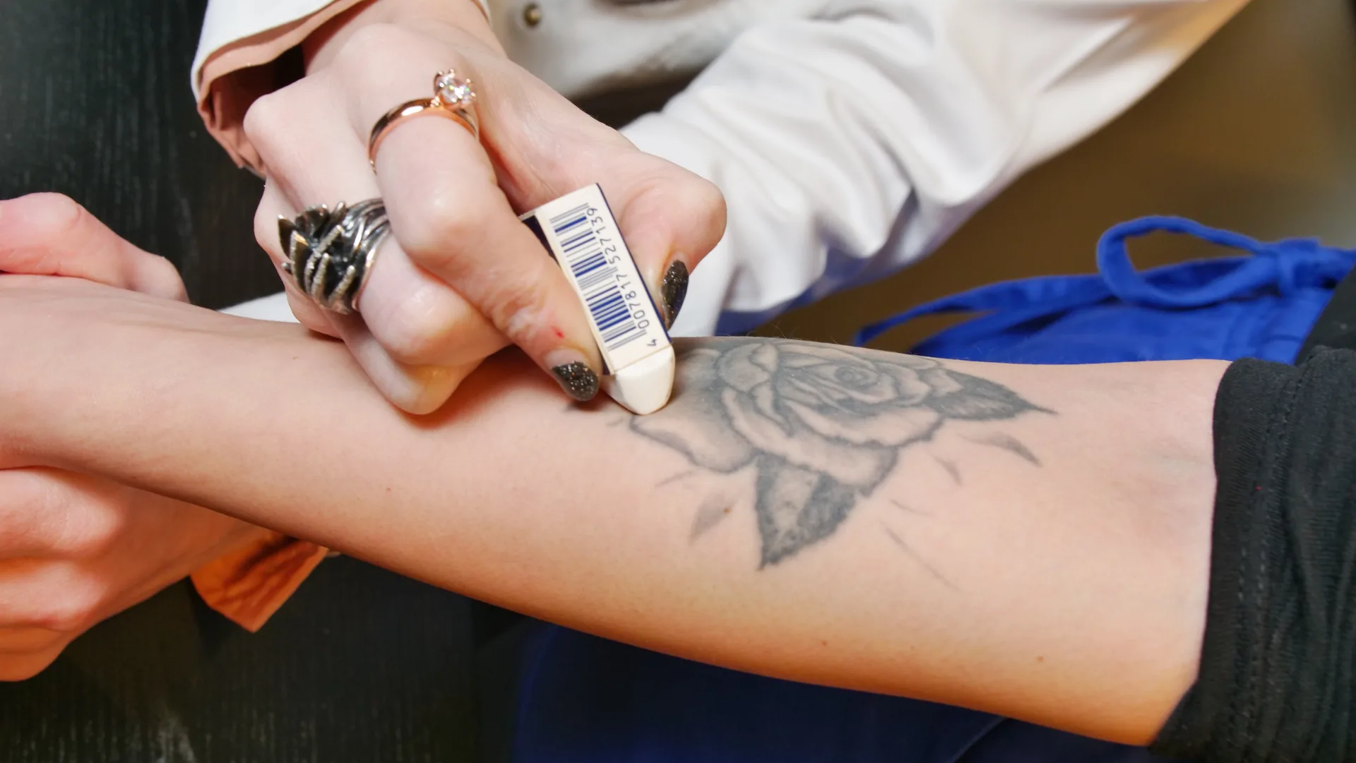 rimozione_tatuaggi